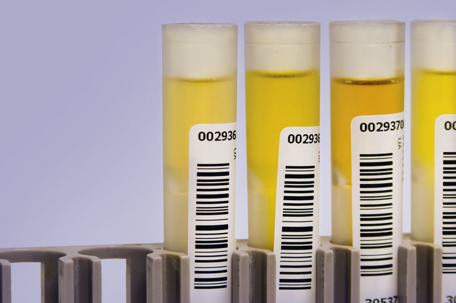 Upass Synthetic Urine Springfield Dayton OH